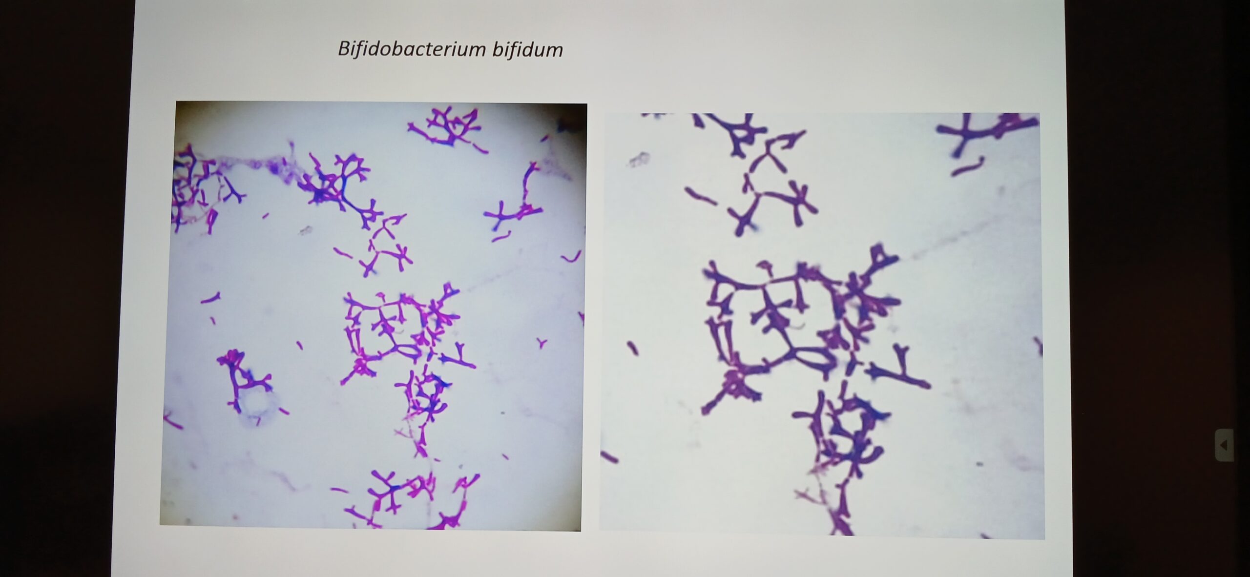 Siła bakterii – tajemnice mikrobioty jelitowej